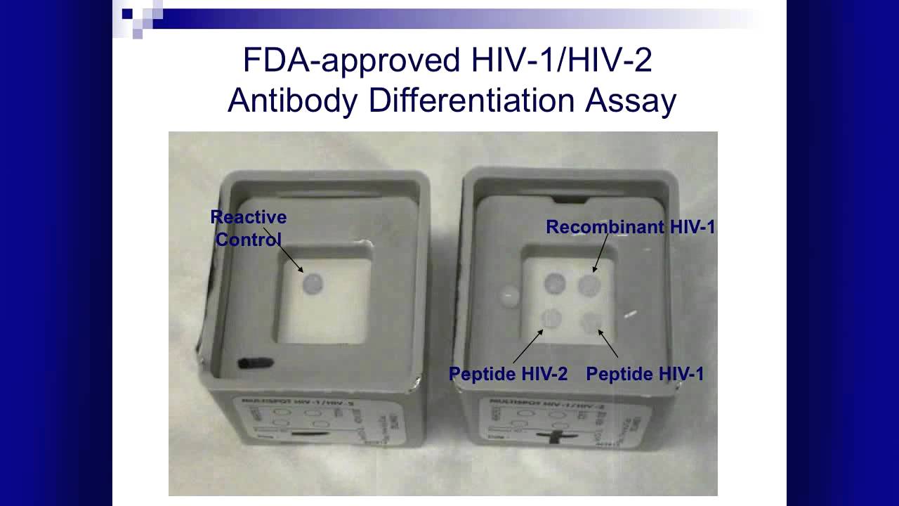 HIV Diagnostics: New Tests and New Algorithms