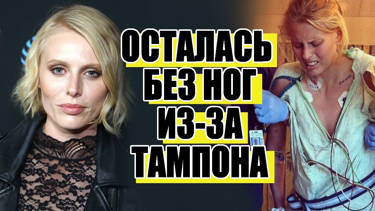 История модели Лорен Вассер, потерявшей ноги из-за тампона