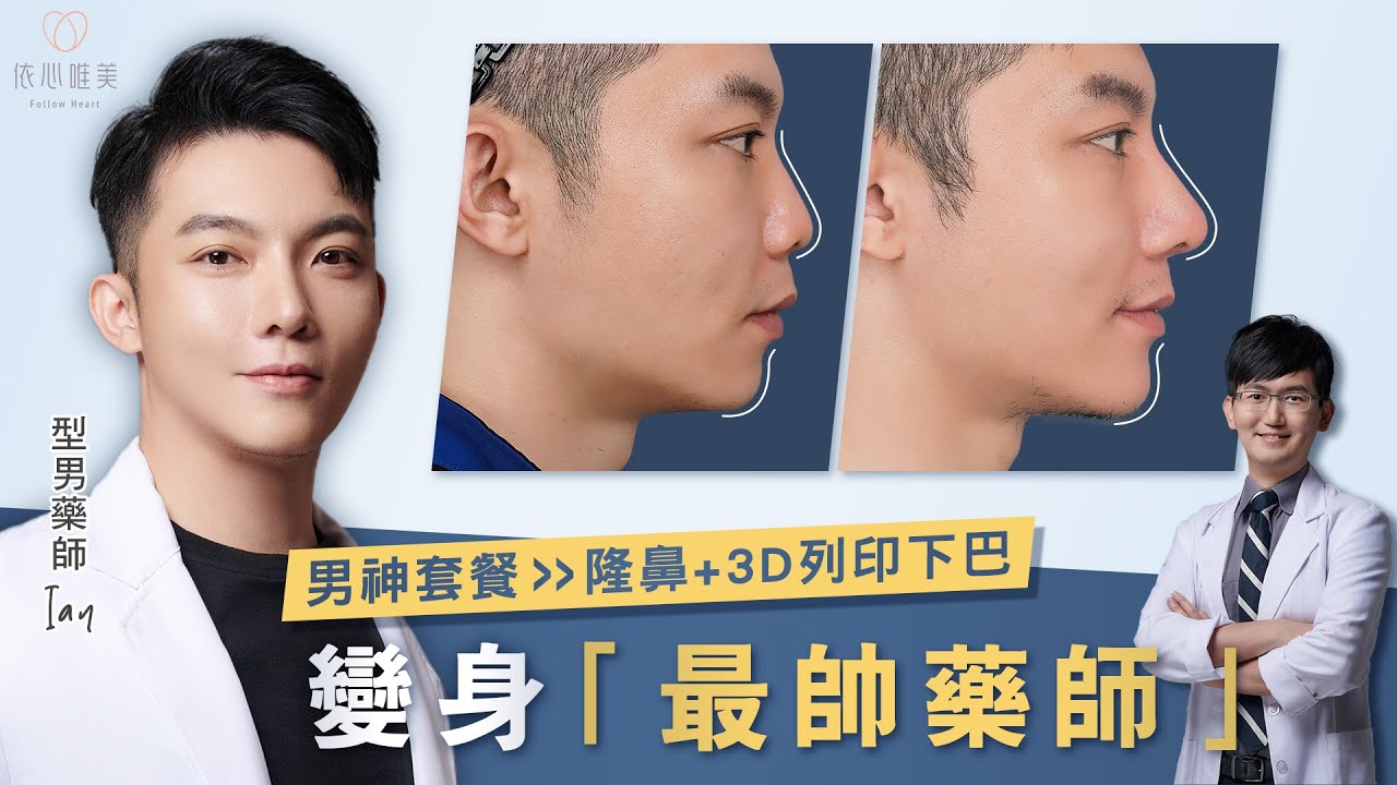 就差那一點！靠隆鼻墊下巴晉身男神💫身為藥師如何選擇安心的醫療團隊？ 男性隆鼻 3D列印下巴 男性整形｜依心唯美 謝東穎醫師