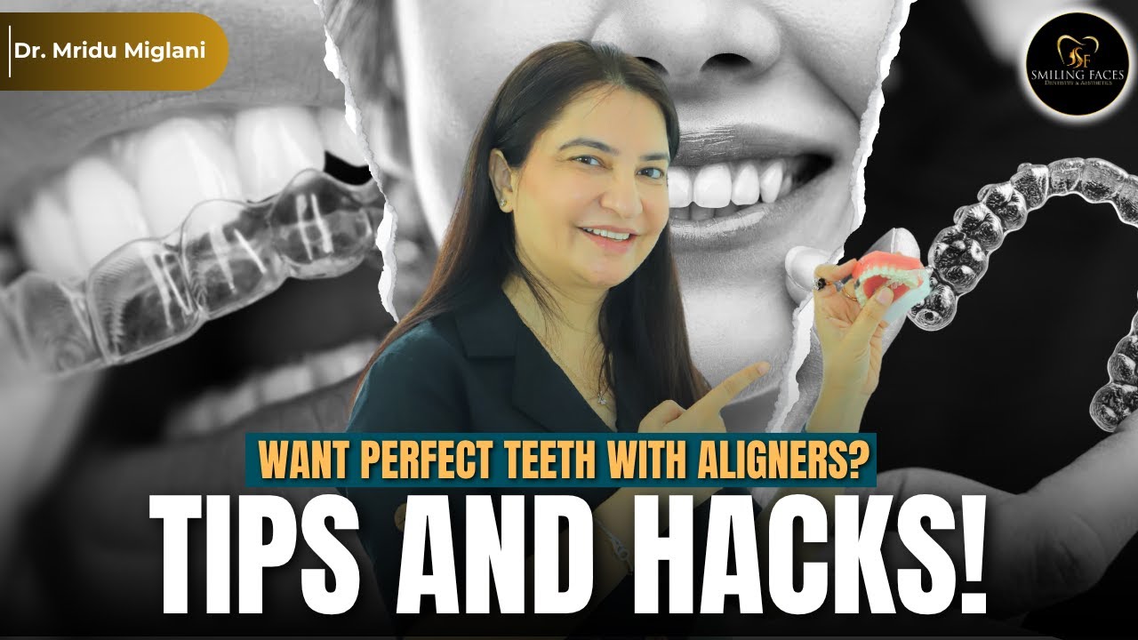Aligners for Perfect Teeth: Pro Tips & Hacks Before Starting