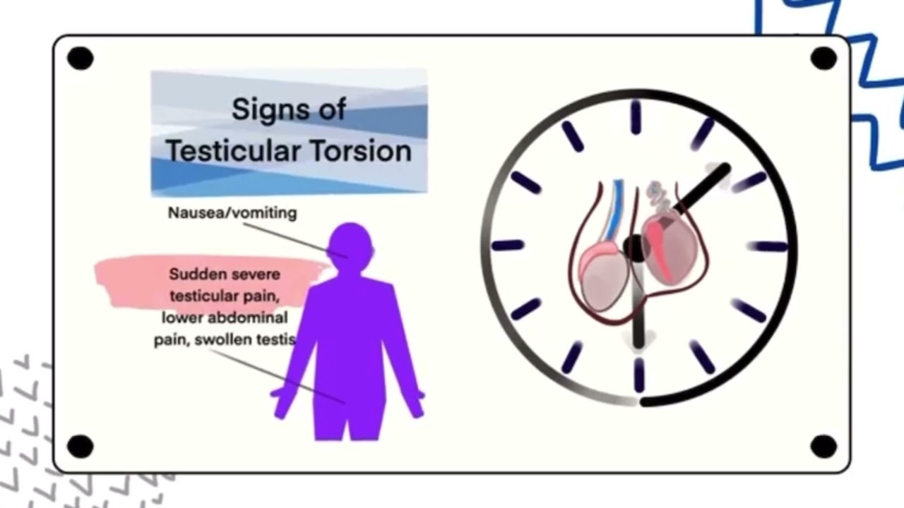 Time is Testicle!