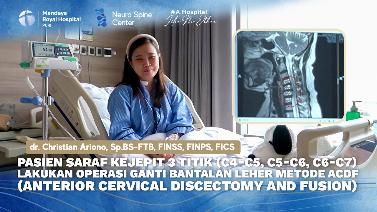 Testimoni Pasien Saraf Kejepit Leher 3 Titik Metode ACDF | dr. Christian Ariono, Sp.BS-FTB, FINSS