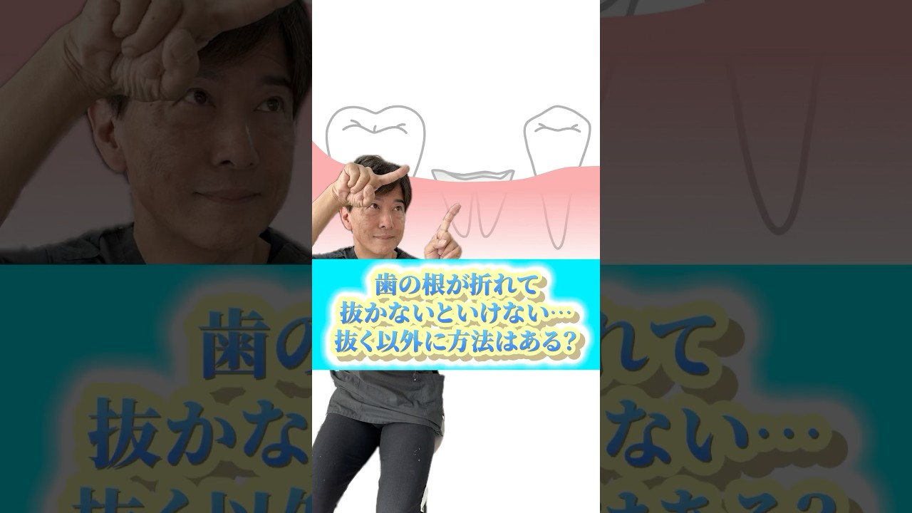 歯の根が折れて抜かないといけない&hellip;抜歯以外に方法はある？　#なかの歯科 #岡山歯医者 #歯根破折 #歯科医師 #抜歯