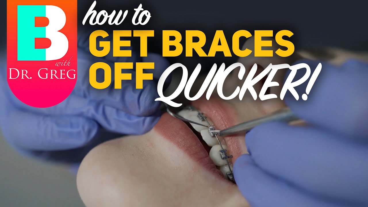 Getting Braces Off Quicker