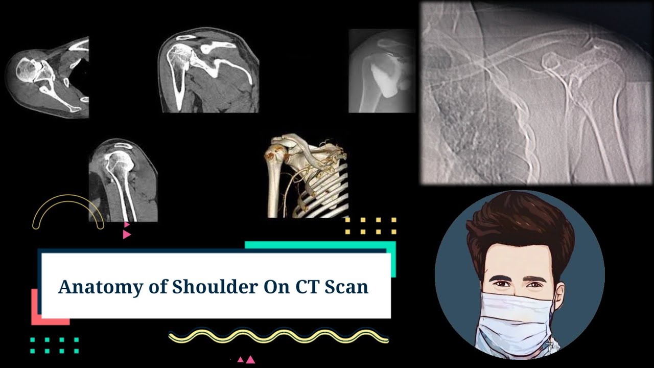 Anatomy of Shoulder On CT scan| By Anis Qureshi