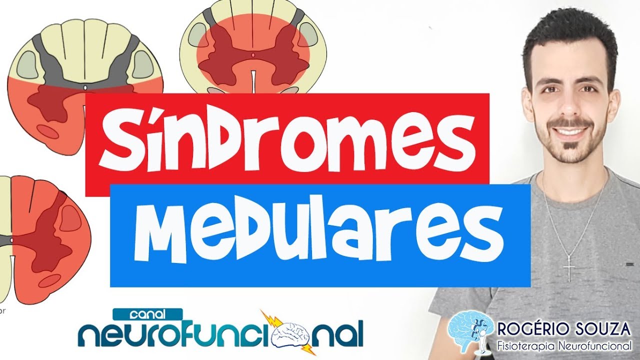 SÍNDROMES MEDULARES (Aula completa) - Rogério Souza