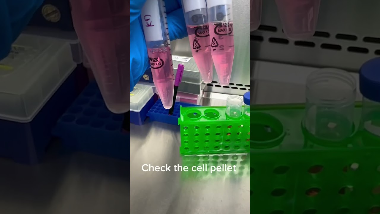 comment décongeler des cellules?