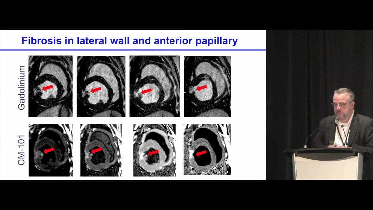 Peter Caravan: Molecular imaging of fibrosis