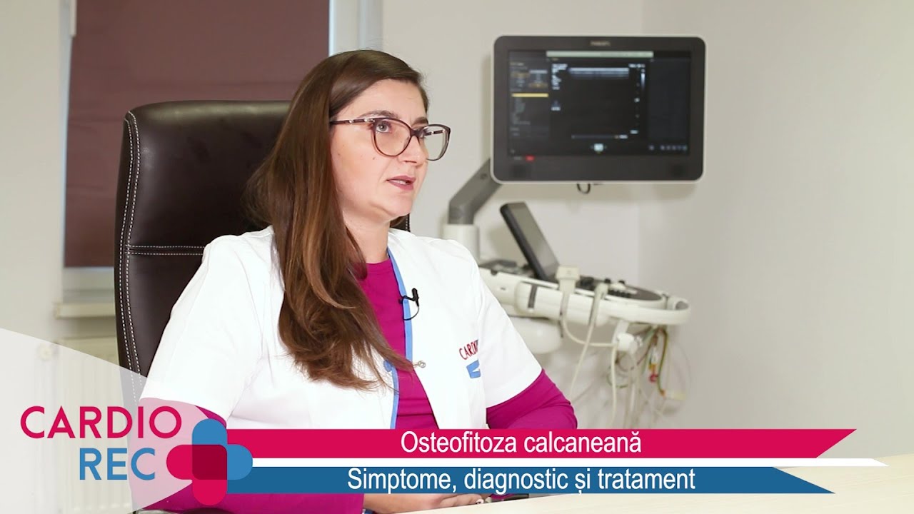 CIOCURILE LA CĂLCÂI: Ce sunt? Cum se pot trata? - Dr. Elena Stancu-Tarhon