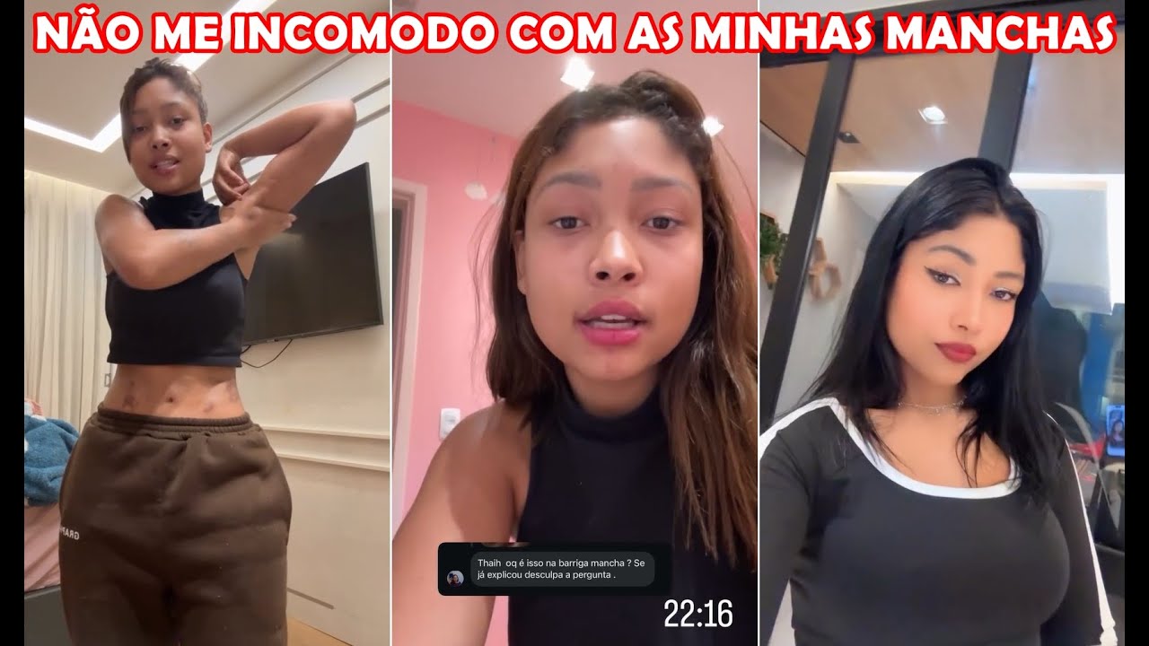Thay Rodrigues: eu não me incomodo com as manchas na minha barriga + Mudei de visual de novo