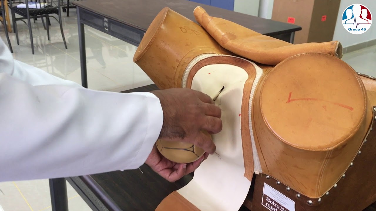 Shoulder Dystocia