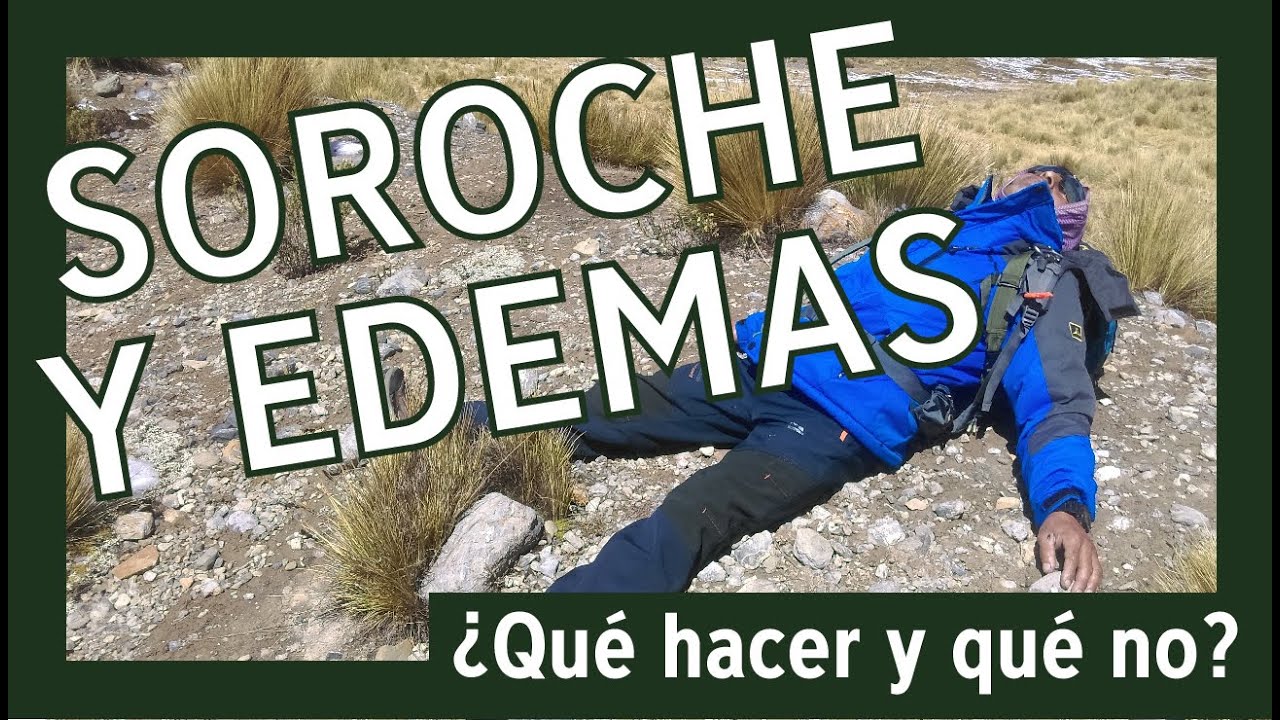 🚨 TEN CUIDADO con el SOROCHE y los EDEMAS 🤢 [Patologías MORTALES de montaña]