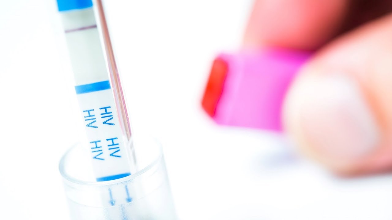 Így működik az otthoni HIV-teszt | HáziPatika