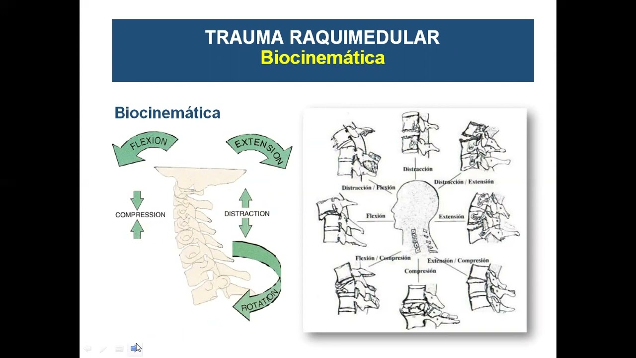 Trauma Raquimedular en CTI. Dra. N Hernández