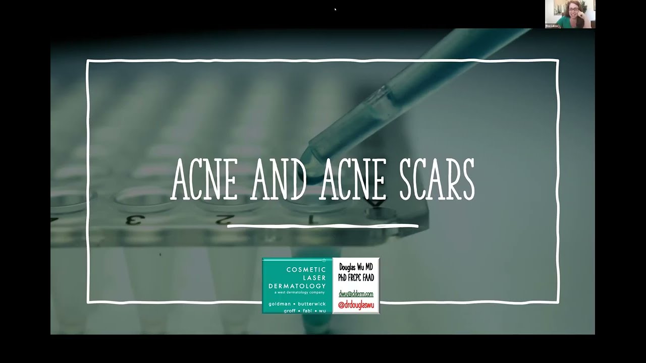 Eliminate Acne and Acne Scarring Once and For All | Dr. Douglas Wu