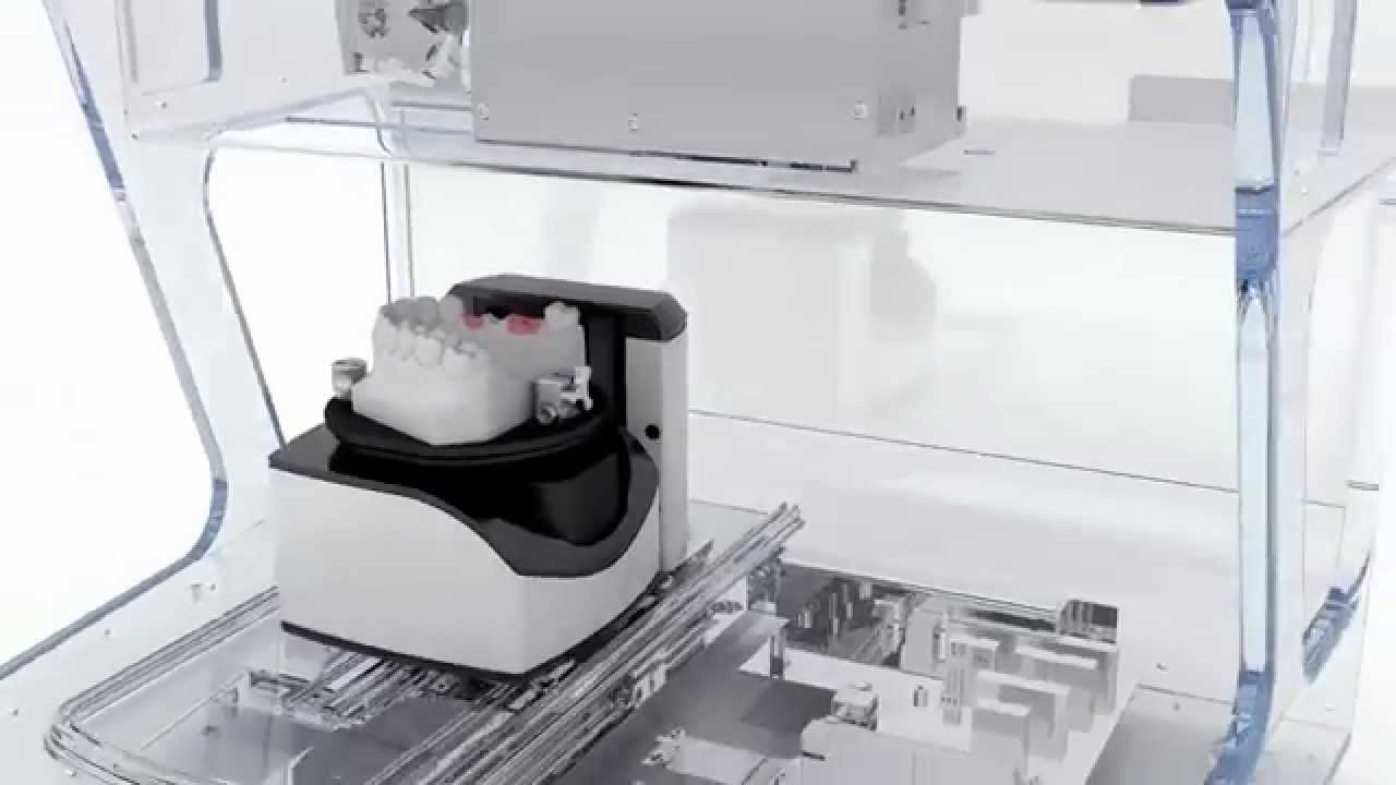 Procera Scanner