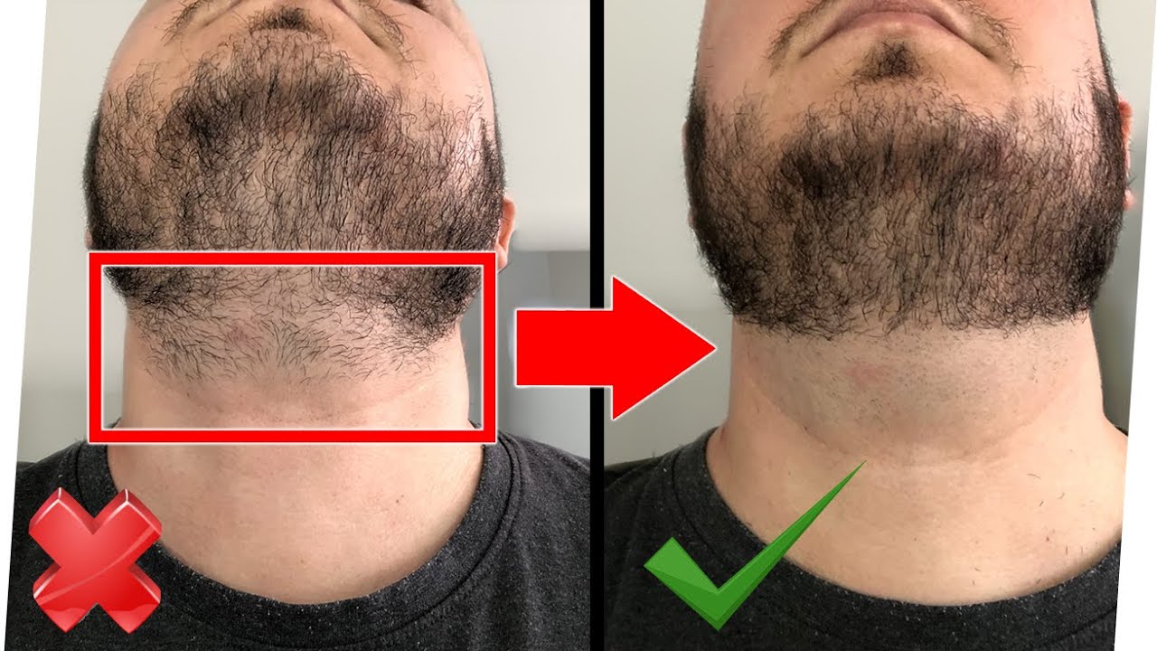 Halskontur EASY selbst rasieren 🚨 weil Barbier ZU