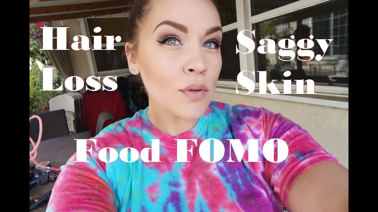 4 Months Post Op VSG - Hair loss, Saggy Skin, Food FOMO