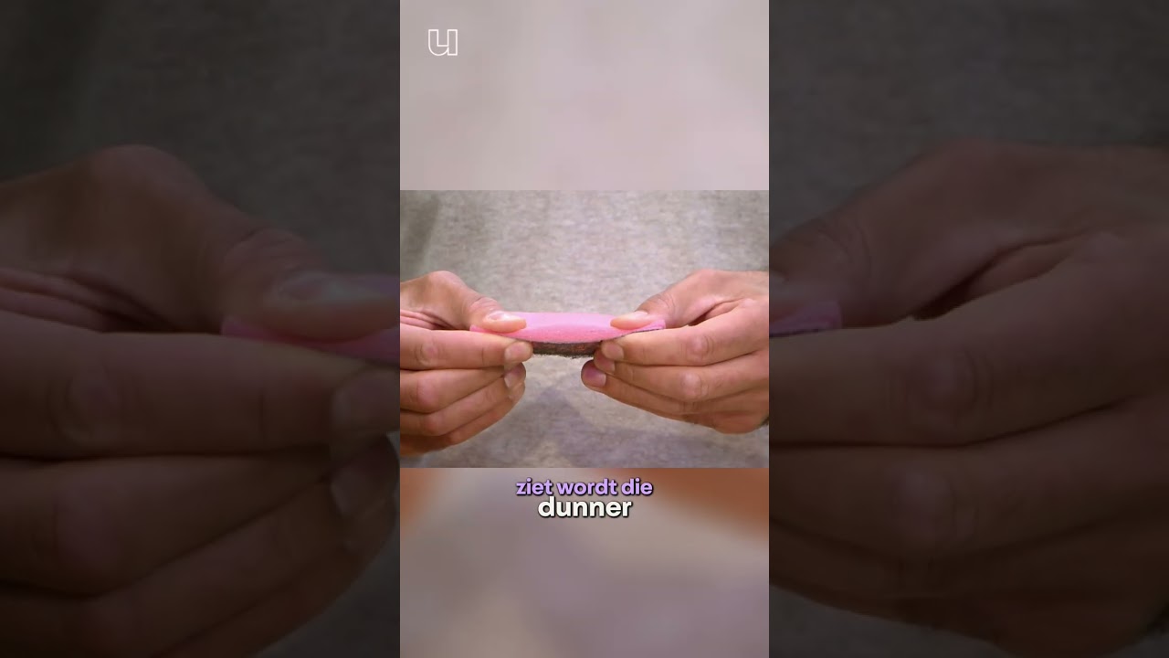 Waarom worden mannen kaal?