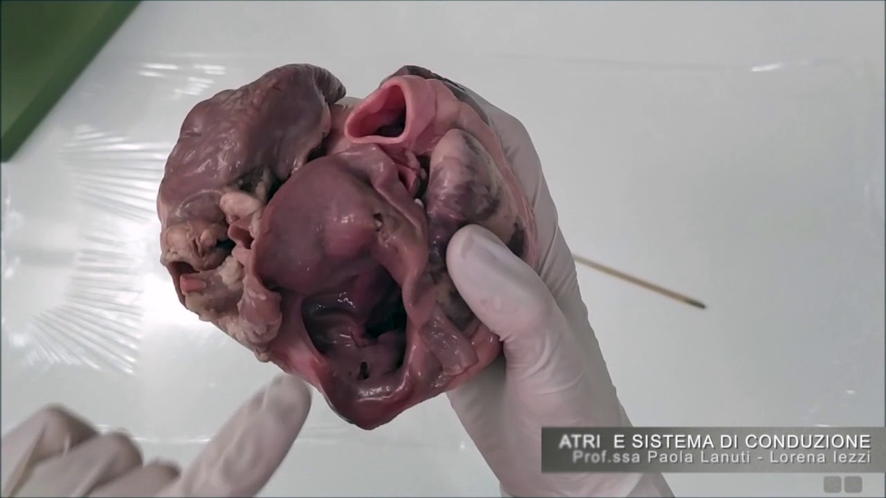 VIDEOCORSO ANATOMIA UMANA CUORE I
