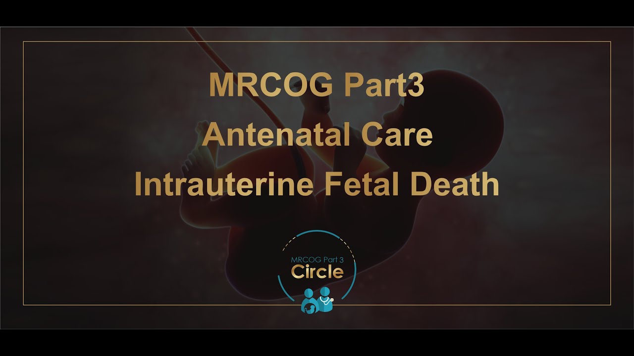 MRCOG Part 3 - Intrauterine Fetal Death (IUFD)