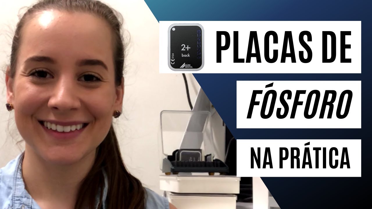 Placas de f&oacute;sforo | Como funciona um sistema digital semi direto?