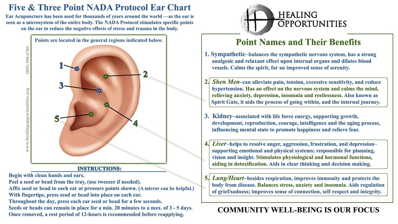 Ear Acupuncture / Acupressure Self Care - Instruction for the NADA Protocol : Seeds & Beads