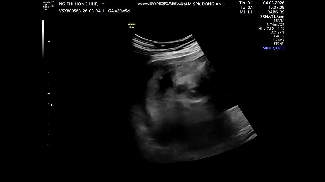 Sản Phụ Khoa Đông Anh - Mẹ NGUYỄN THỊ HỒNG HUẾ