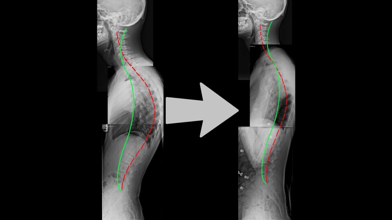 Posture + Spine Enhancer