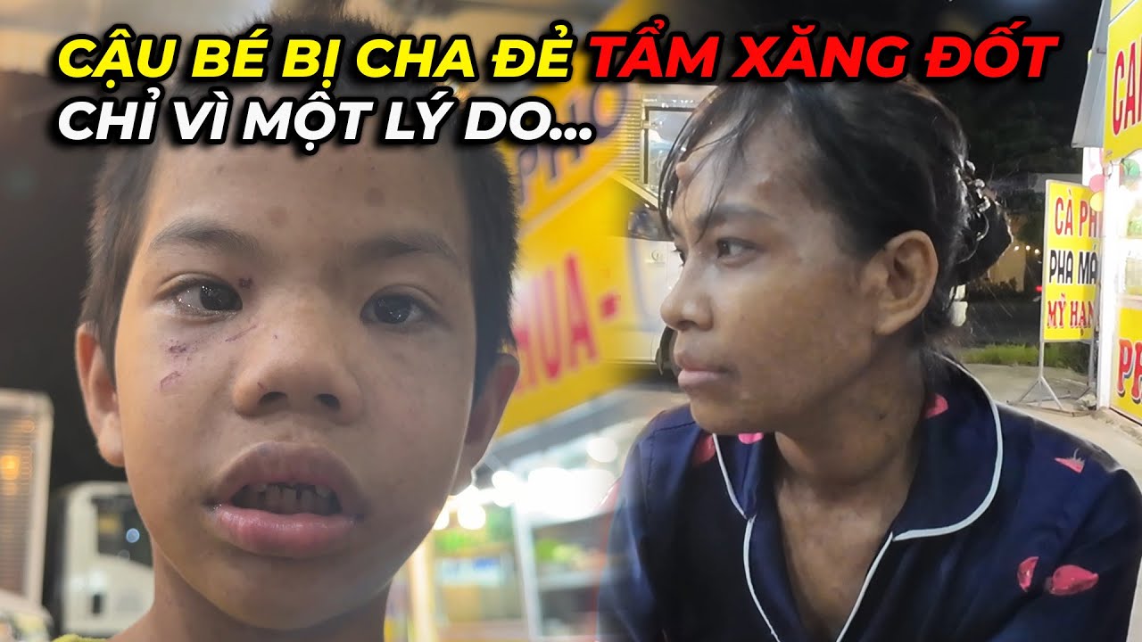 Phẫn nộ!!! Cậu bé bị cha đẻ tẩm xăng đốt chỉ vì 1 lý do…