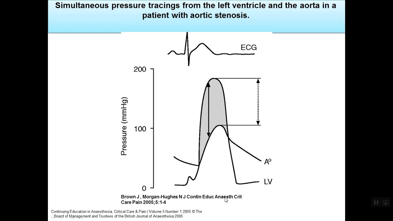 Hemodynamics (Part 2) - Prof. Dr Khaled Sorour