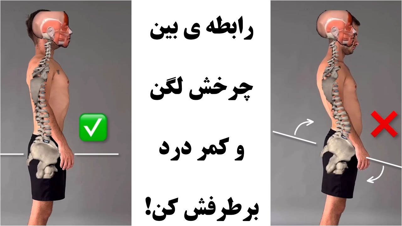 چرخش لگن باعث کمر درد میشه ( باعث کاهش قد و زشت شدن شکم هم میشه )
