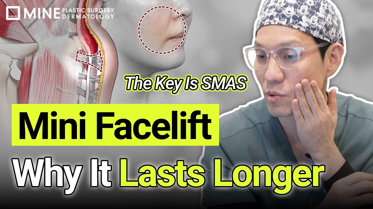 Mini Facelift Explained | Why SMAS Lifting Lasts Longer Than Threads or Lasers