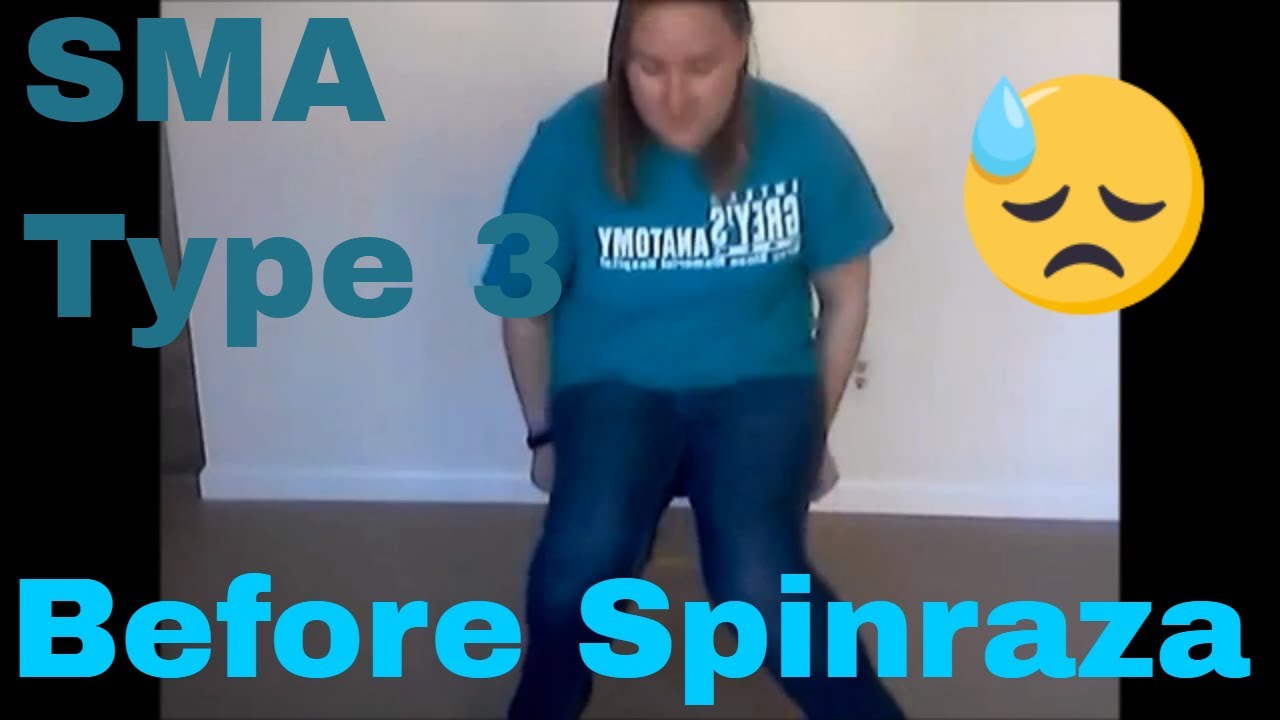 Before Spinraza SMA Type 3 Adult