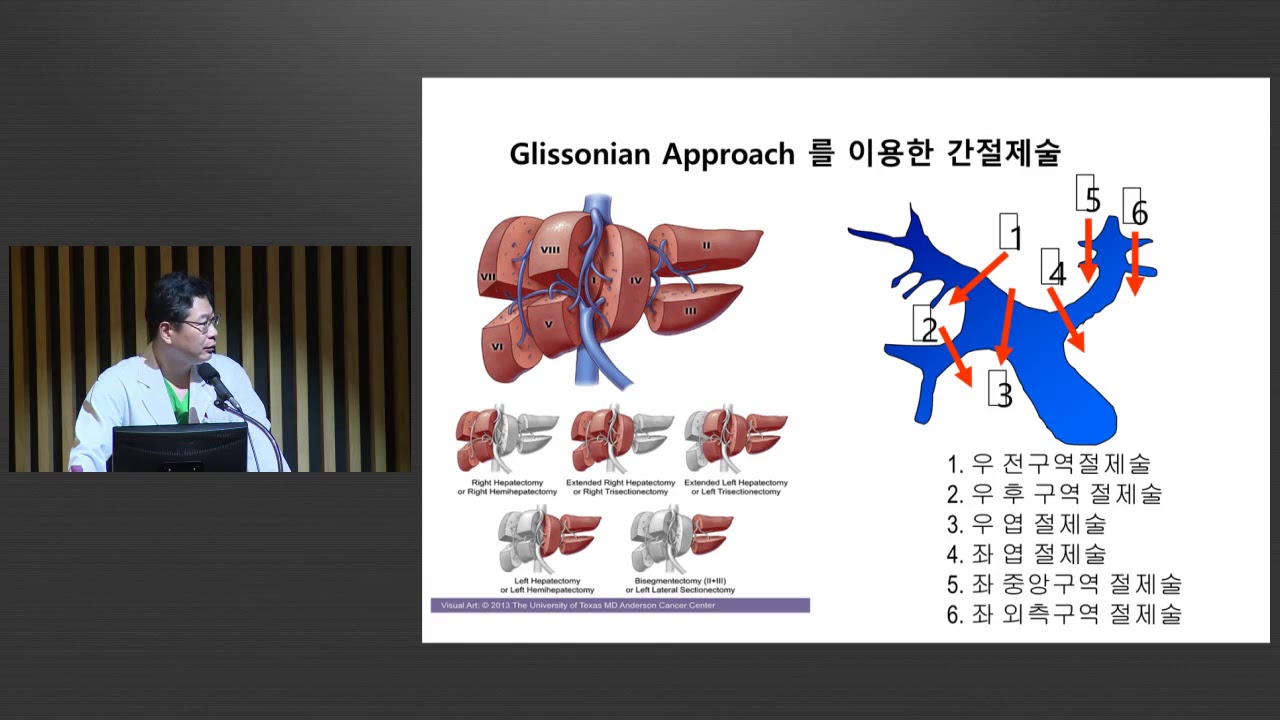 간암의 수술적 치료