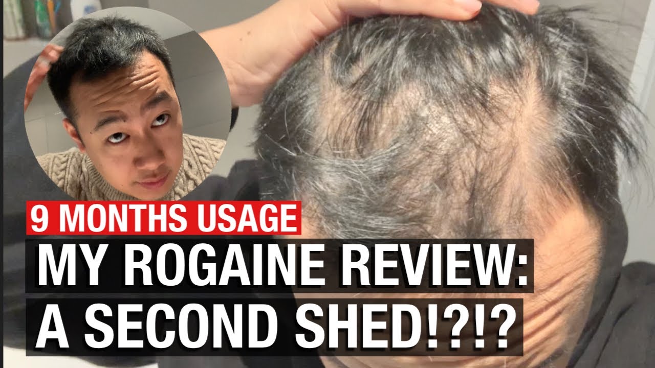 9 МЕСЯЦЕВ ИСПОЛЬЗОВАНИЯ: МОЙ ОТЗЫВ О ROGAINE, ВТОРОЙ САРАШ?!?!