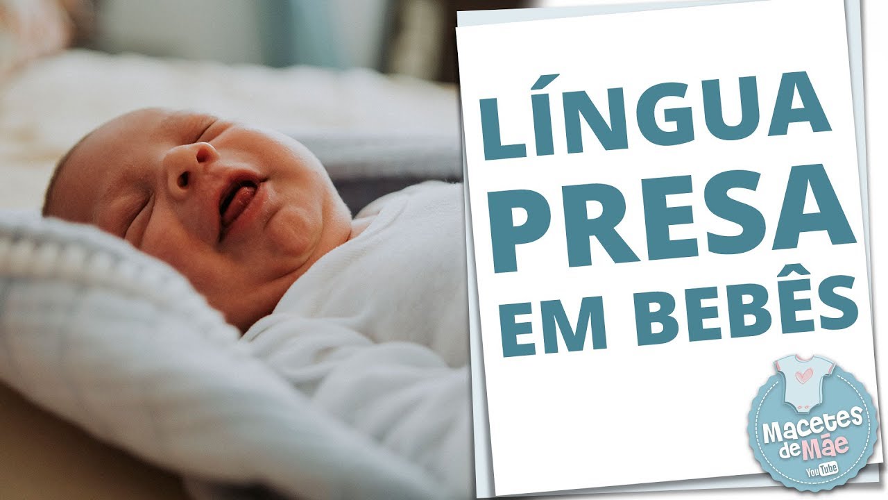 LÍNGUA PRESA EM BEBÊS E COMO ELA INTERFERE NA AMAMENTAÇÃO | MACETES DE MÃE
