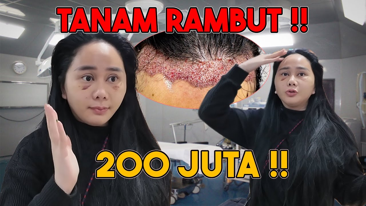 DENISE OPLAS TANAM RAMBUT 200 JUTA !!??