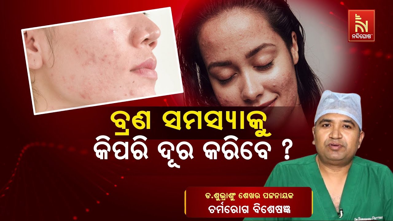 Pimple Removing Tips | Treatment & Prevention | Dr. Subhranshu Sekhar Pattnaik | Swasthyasutra