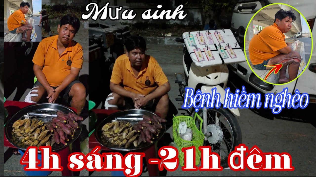 Quá xót thương cho hoàn cảnh em Nguyện mắt căn bệnh hiểm nghèo l khiến người xem phải bật khóc