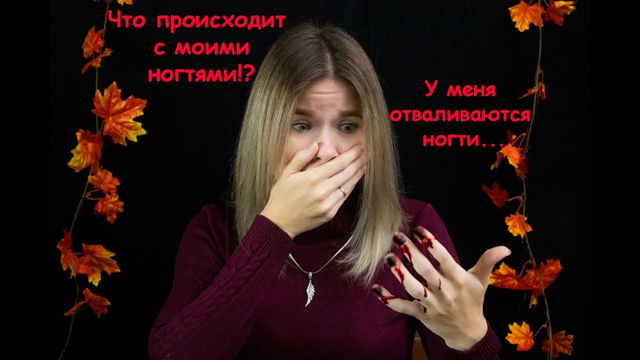 У МЕНЯ ОТВАЛИВАЮТСЯ НОГТИ | История моей аллергии на гель-лак