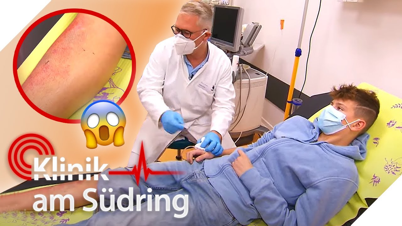 Komplizierter Beinbruch: Hat sich Simon schon wieder geprügelt? | Klinik am Südring | SAT.1