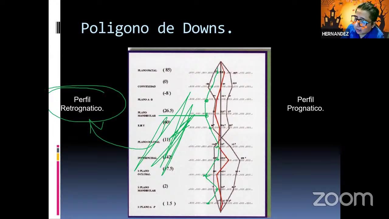 Analisis cefalometrico Downs
