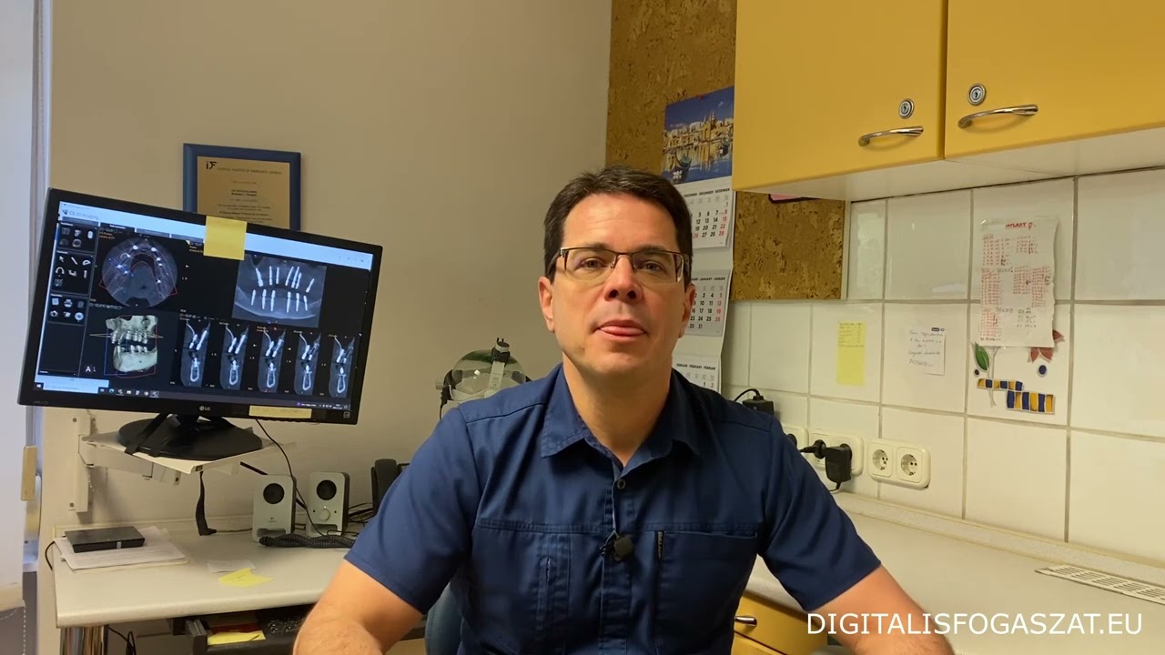 📌Hogyan kell terhelni a fogászati implantátumot?