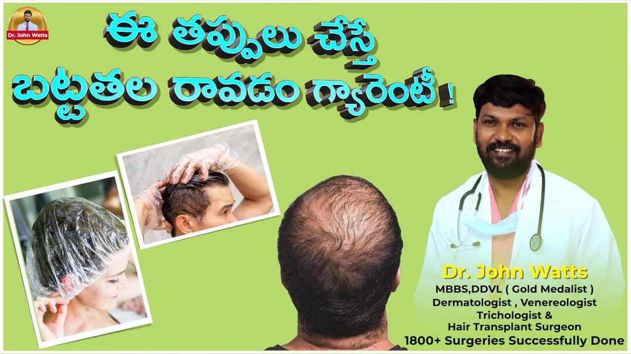 ఈ తప్పులు చేస్తే బట్టతల రావడం గ్యారెంటీ !| Making These Mistakes Can Lead to Baldness!