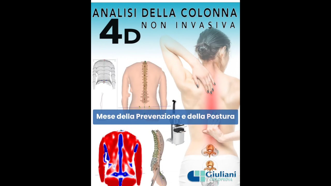 Il Mese della Postura da Ortopedia Giuliani Vetralla