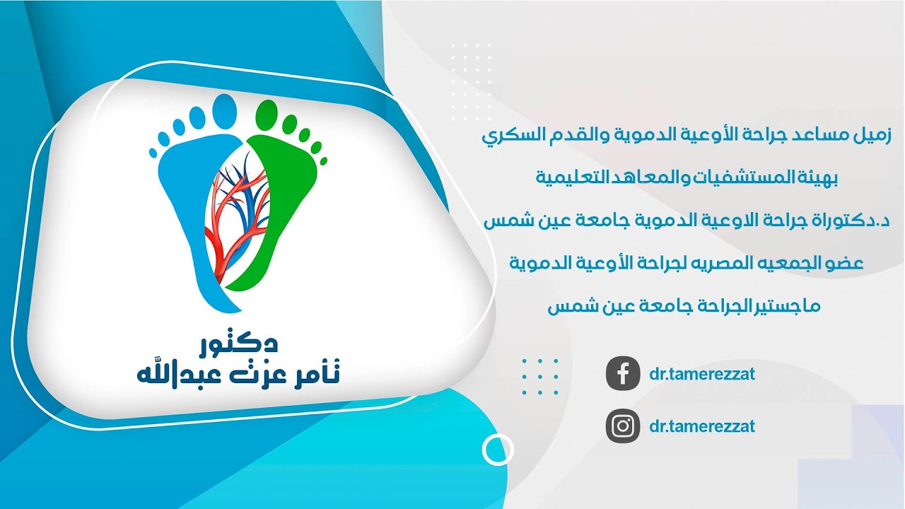 الدوالي ممكن متكونش دوالي