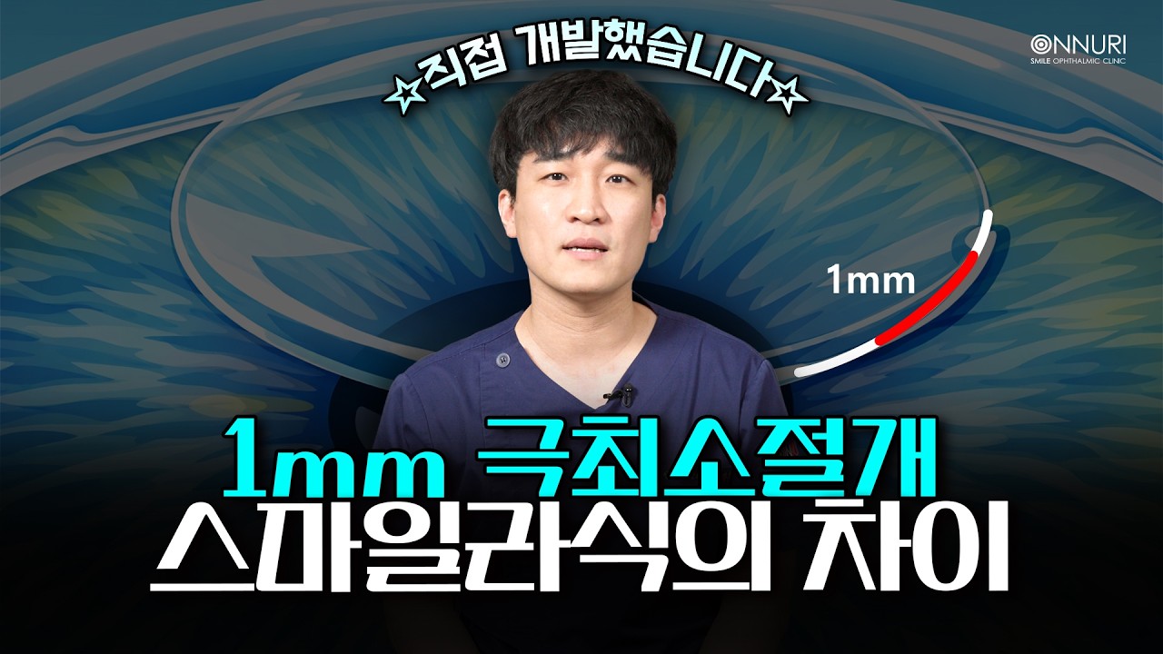 스마일라식, 1mm 차이가 만드는 변화👀