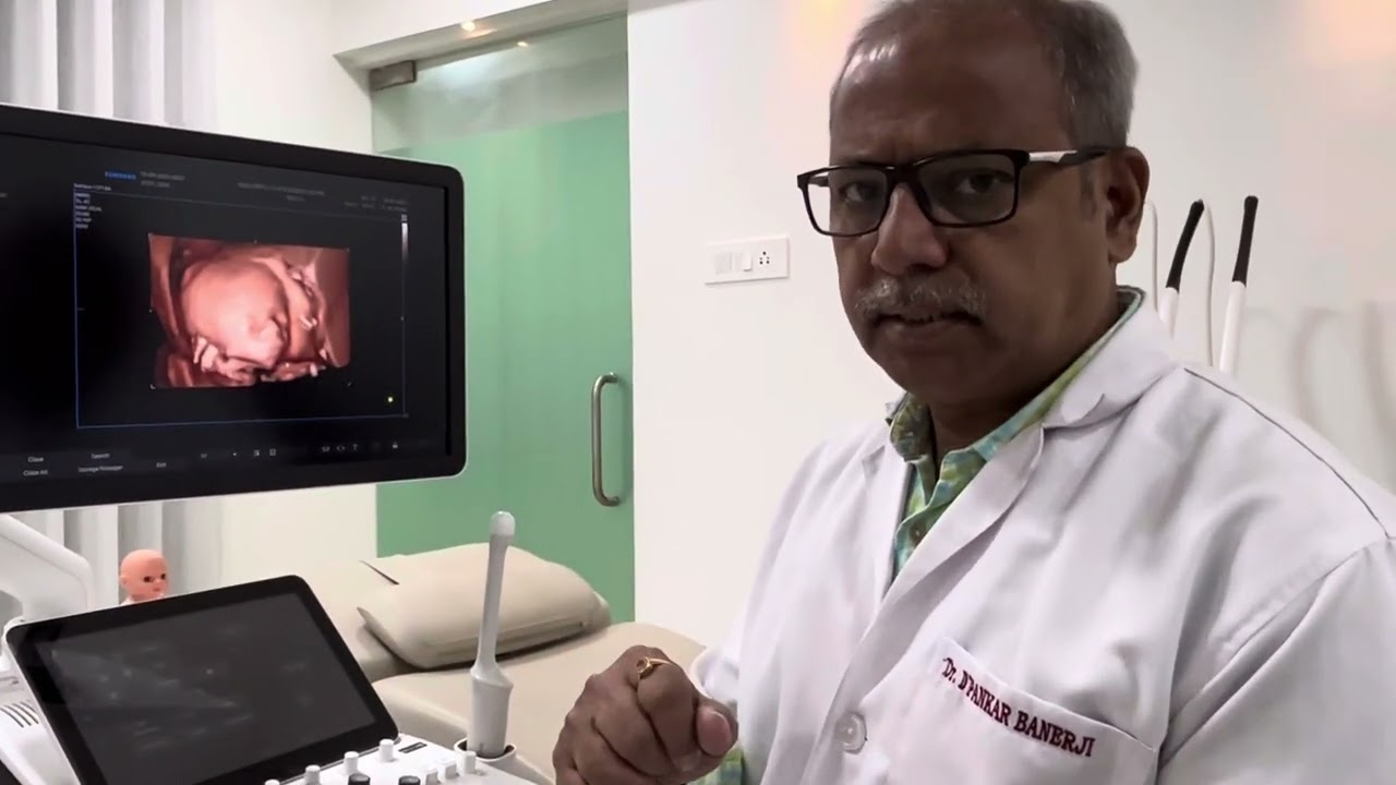 Absent Nasal Bone and Amniocentesis