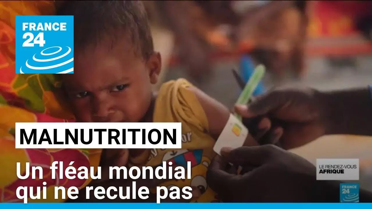 Malnutrition : un fléau mondial qui ne recule pas • FRANCE 24